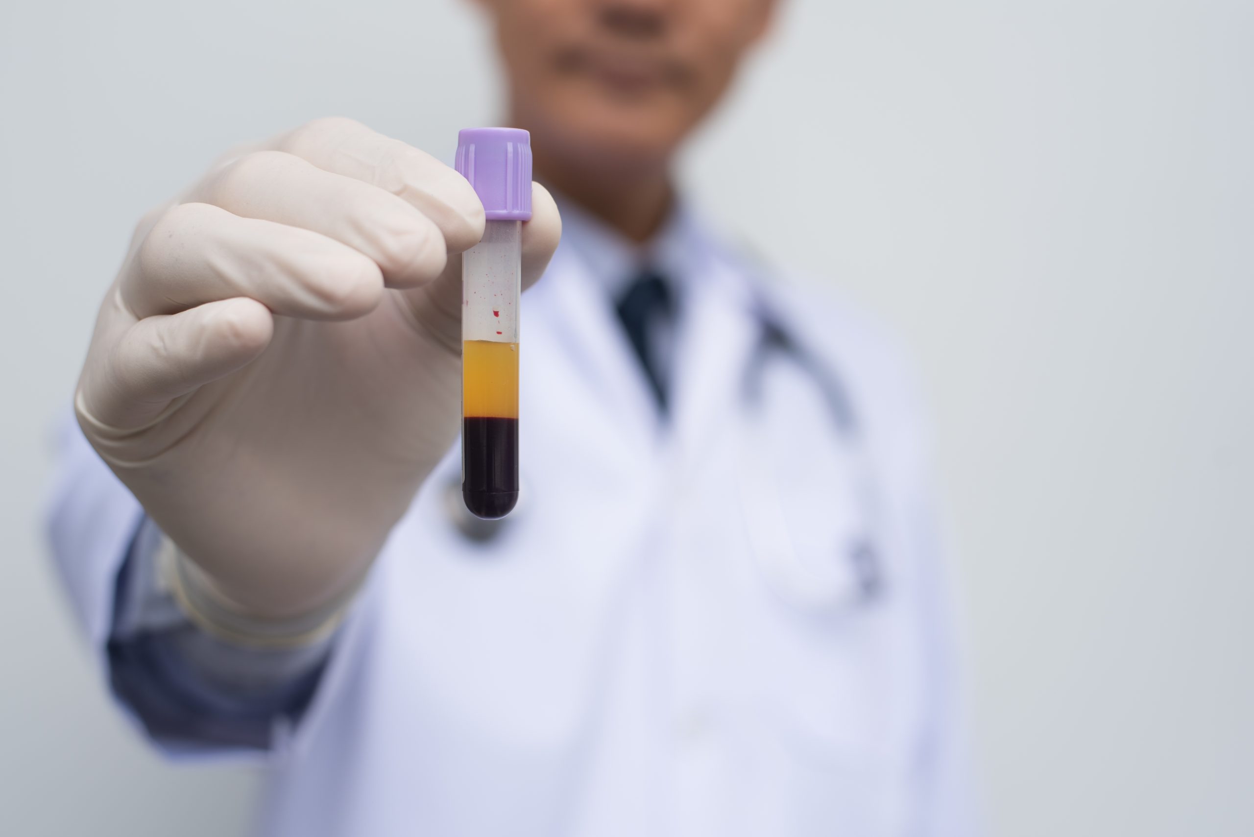 Male,Doctor,Or,Technician,Holding,Centrifuge,Blood,Or,Blood,Fractionation